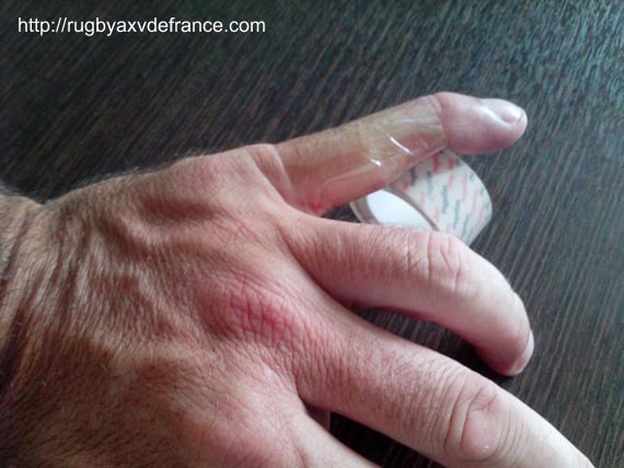 INFIRMERIE: comment confectionner une attelle pour protéger un doigt foulé